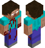 preview for Self harm steve